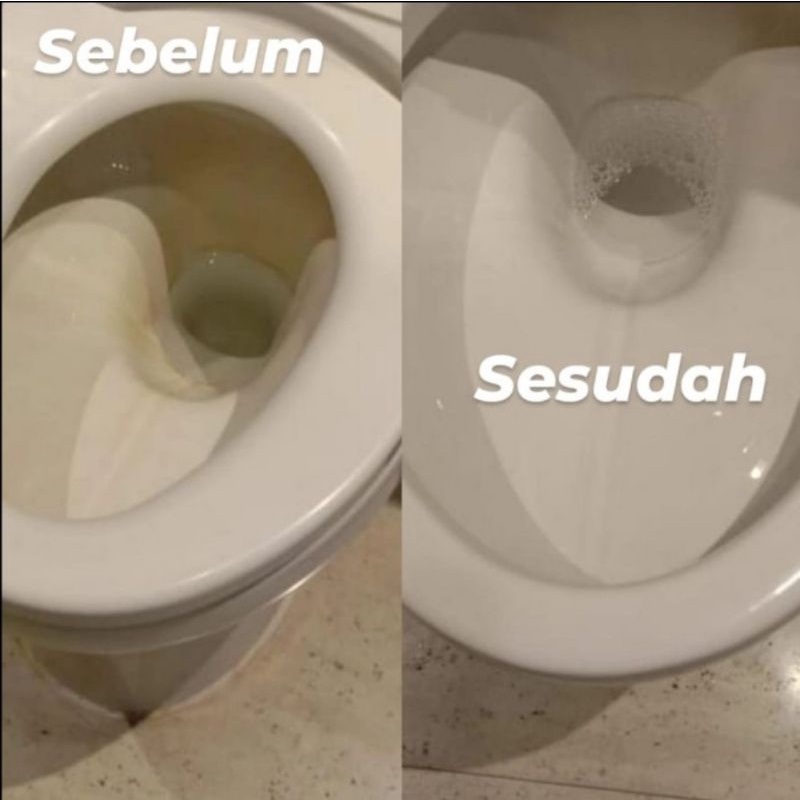 Snap Clean Pembersih Toilet & Keramik Kamar Mandi Bowl Getter 4L